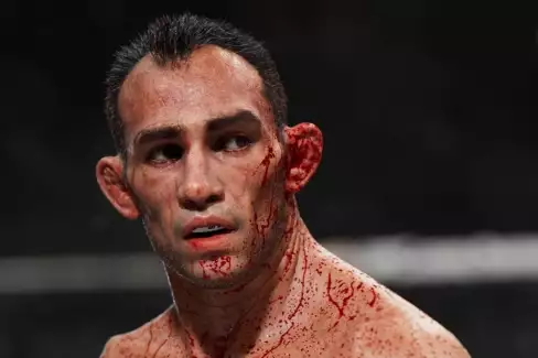 Veterán Tony Ferguson přiznal, s jakým zraněním šel do souboje s Pimblettem