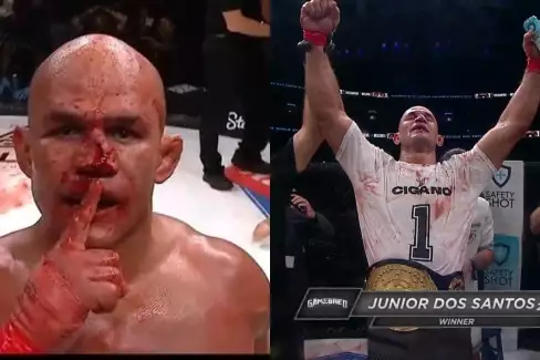 Bývalý šampion UFC získal v krvavé lázni titul v Masvidalově organizaci