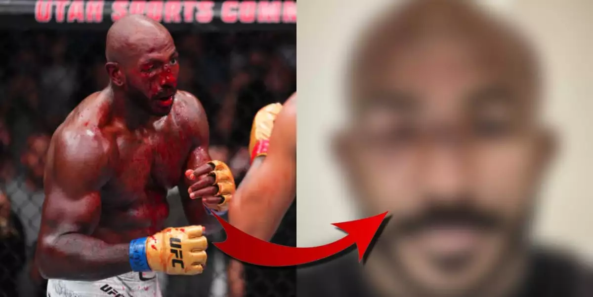 Jak vypadá rozsekaný Khalil Rountree den po bitvě s Alexem Pereirou?