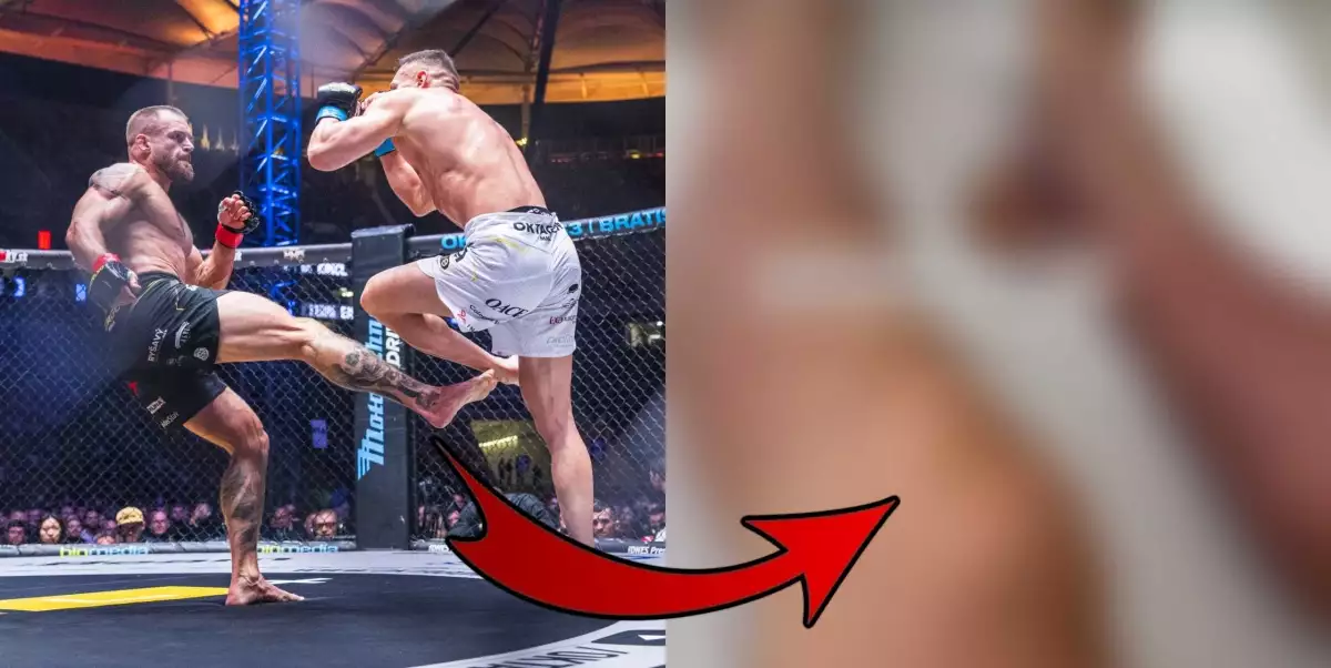 VIDEO: Ty kráso! Šampion Engizek odhalil, jak po bitvě s Kinclem vypadají jeho nohy
