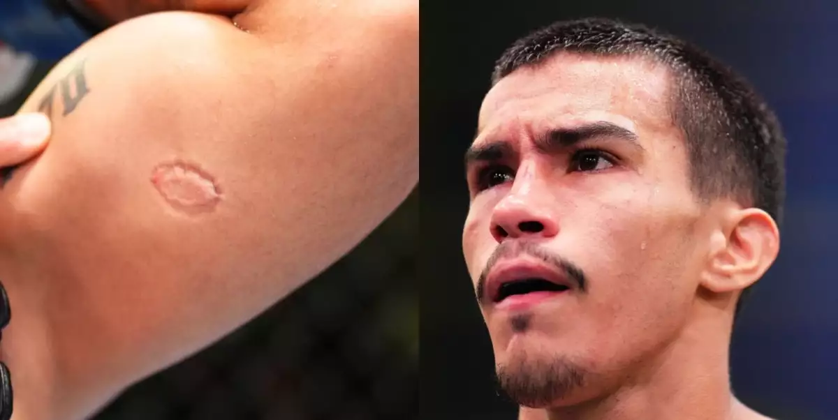 Tohle nejsem já! Severino poprvé promluvil o kousnutí soupeře a vyhazovu z UFC