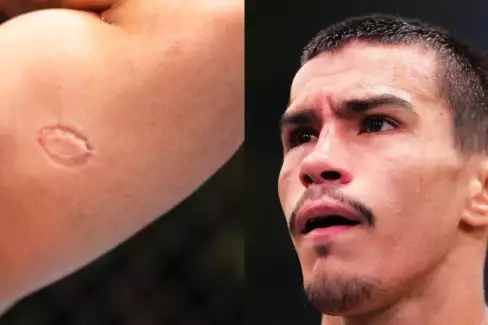 Tohle nejsem já! Severino poprvé promluvil o kousnutí soupeře a vyhazovu z UFC