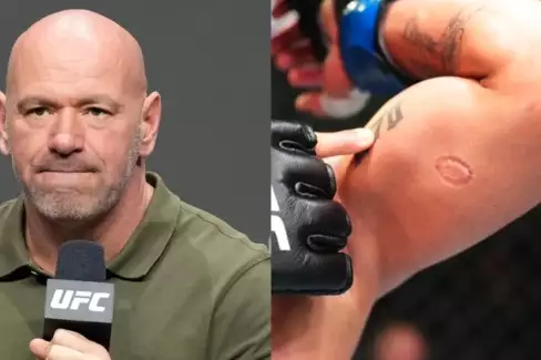 Zahrál si na Tysona a pokousal soupeře! White zuří a UFC přichází s přísným trestem