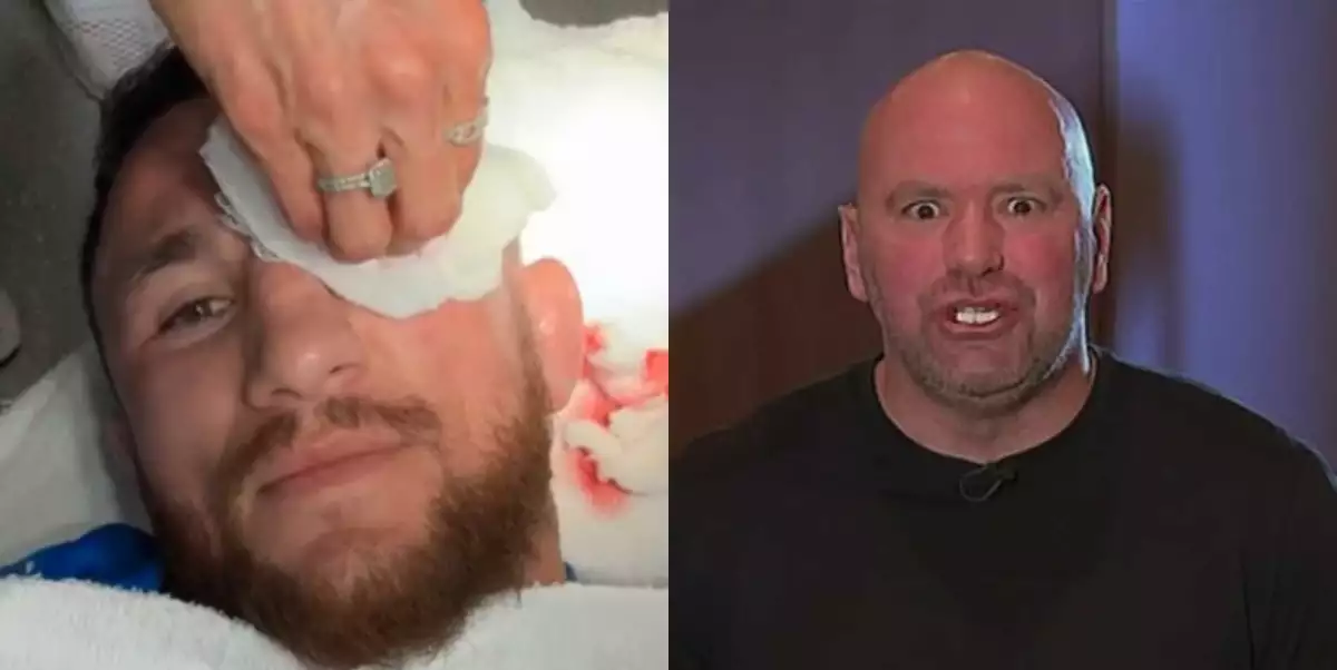 Do nebe volající debilita? Rozzuřený White se hodně ostře opřel do Dvalishviliho