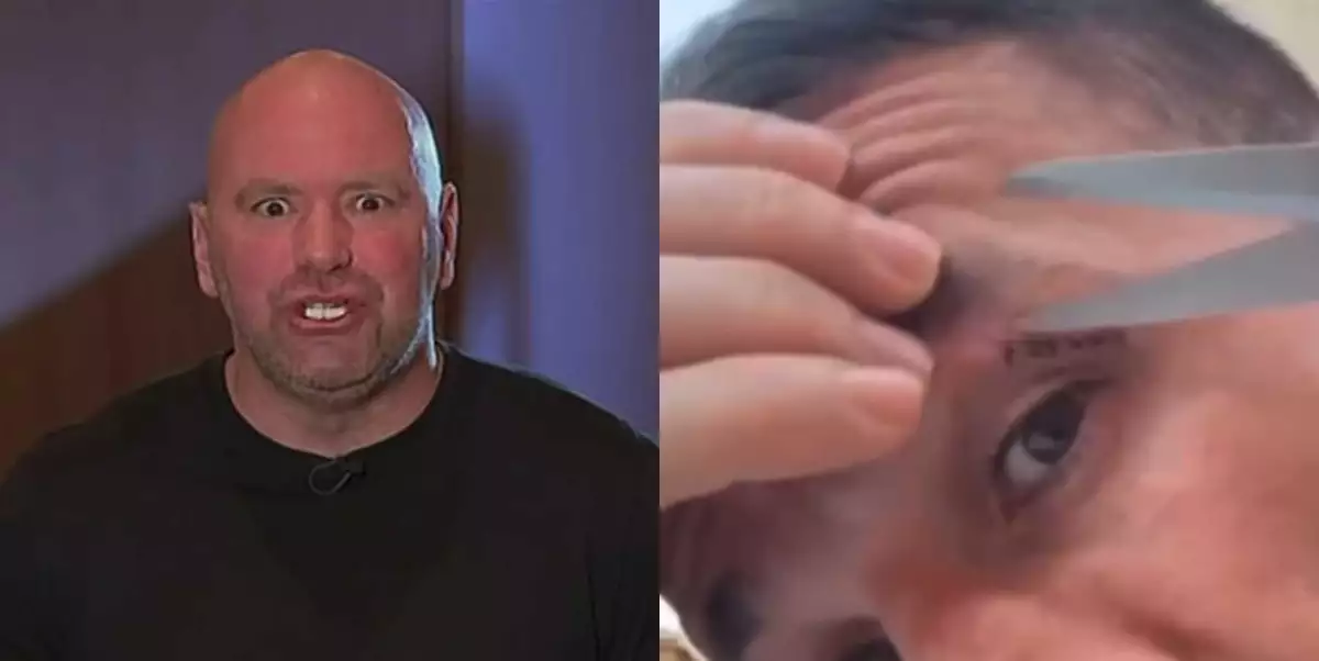 Teď už se mnou vyje*ává! White reaguje na Dvalishviliho, který si vyndal stehy obřími nůžkami