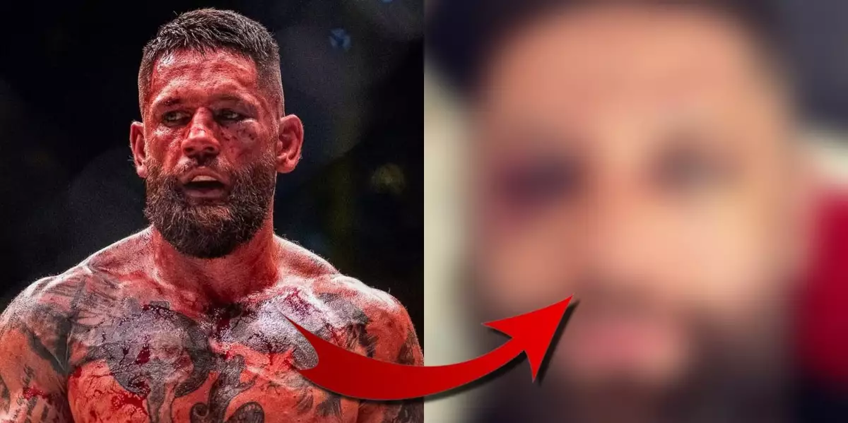 Válečník Vlasto Čepo ukázal, jak jeho tvář vypadá necelý týden po tvrdé titulové bitvě