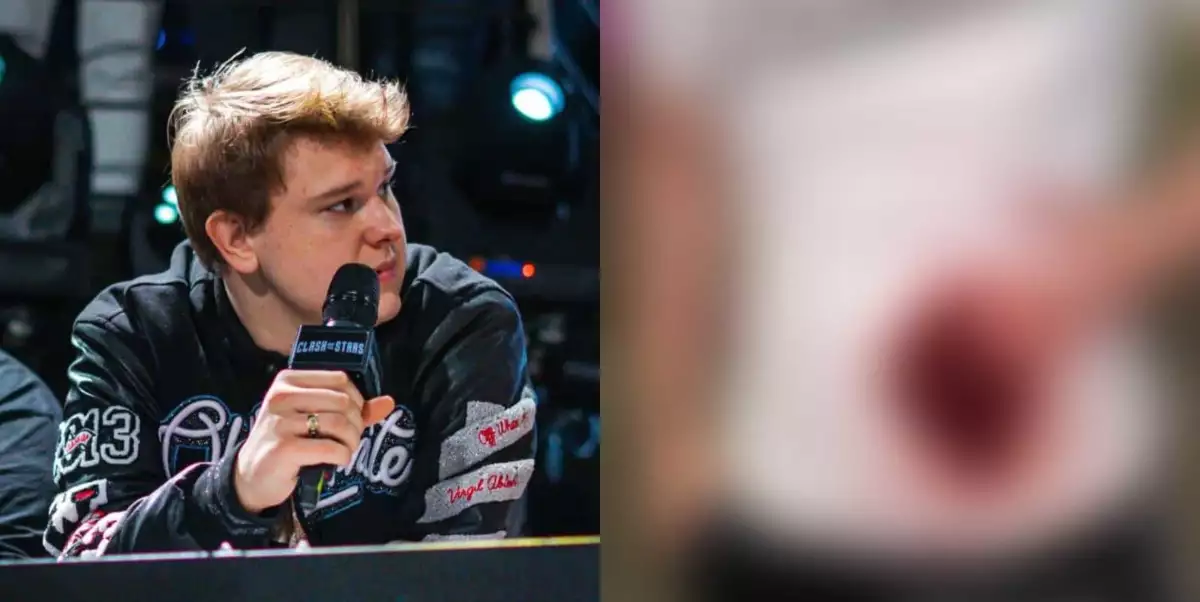 VIDEO: Co to sakra je? Tadeáš Veselý bodl do břicha svého možného vyzyvatele?