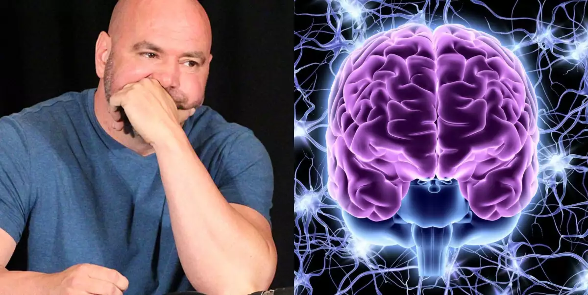 To nezní moc dobře! UFC ředitel Dana White odhalil, jak vypadá sken jeho mozku