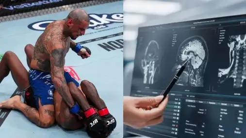 Hned tři zápasníci skončili po tvrdých bitvách na UFC 318 v nemocnici