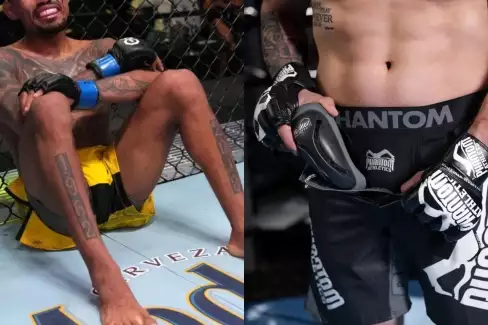 Noste ochranu! Bývalý zápasník UFC se pochlubil s bizarním zraněním penisu