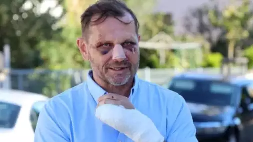 Jak Soukup dopadl po napadení, po kterém skončil v nemocnici?