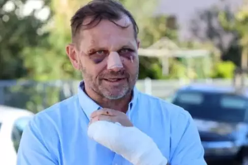 Jak Soukup dopadl po napadení, po kterém skončil v nemocnici?
