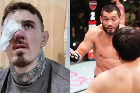 Jak trestat nepříjemné píchnutí do očí? Zde jsou tři zajímavé způsoby