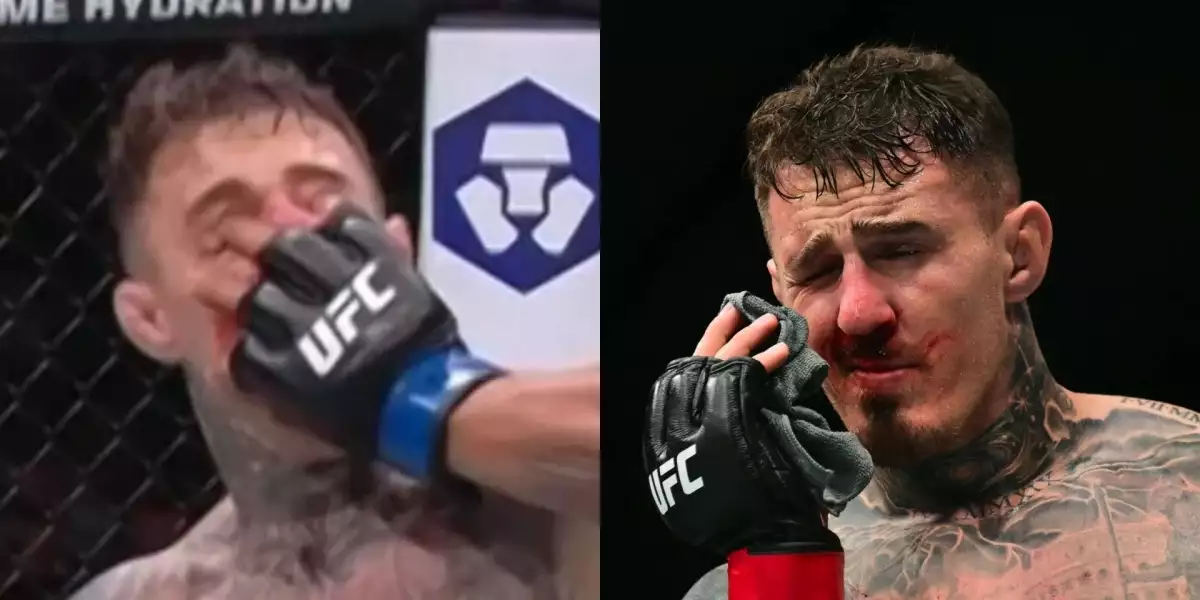 Hodně lidí má už dost úderů do očí! Dojde konečně ke změnám v pravidlech?