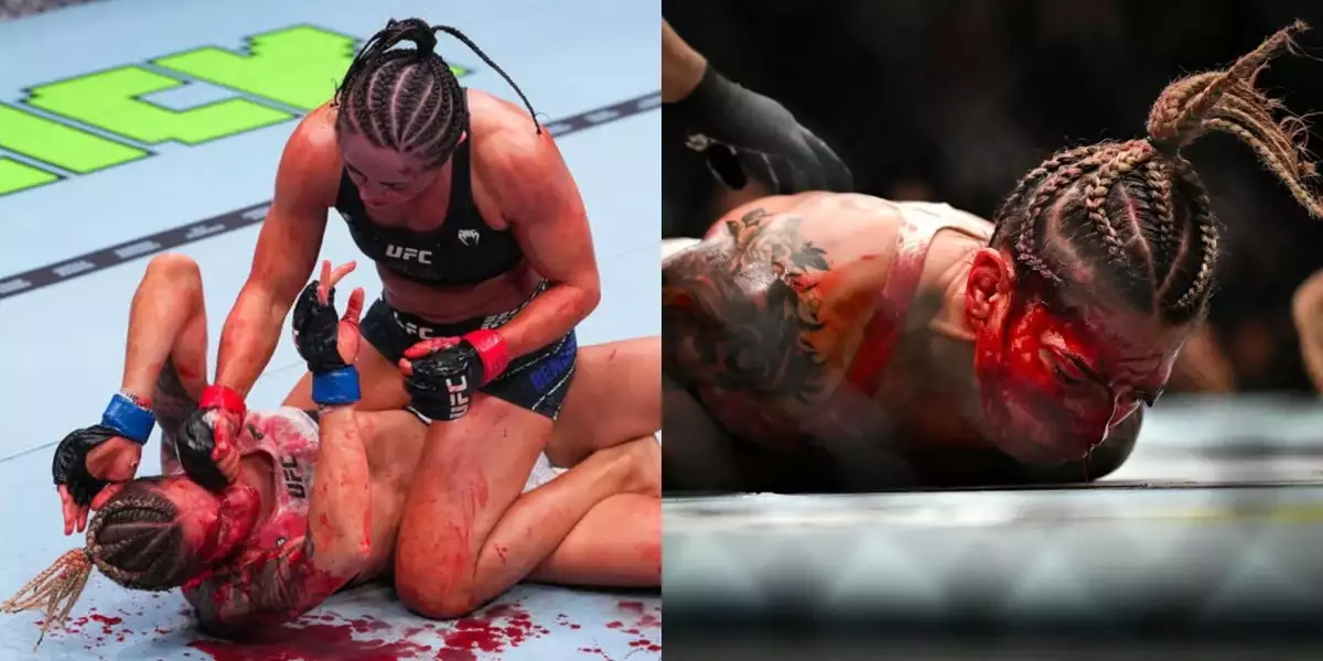 Nepříjemně krvavá UFC premiéra skončila převozem do nemocnice