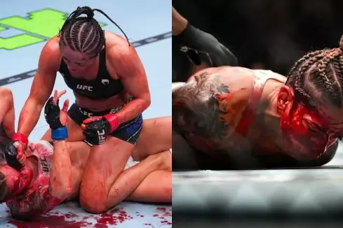 Nepříjemně krvavá UFC premiéra skončila převozem do nemocnice