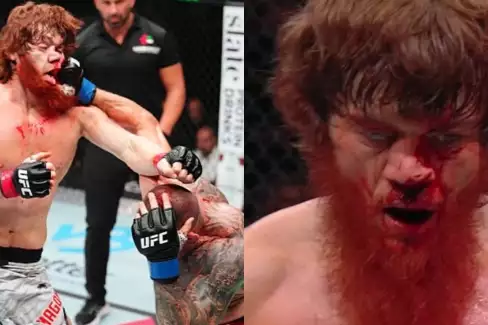 VIDEO: Děsivý Magomedov utrpěl v krvavé bitvě ošklivou zlomeninu nosu