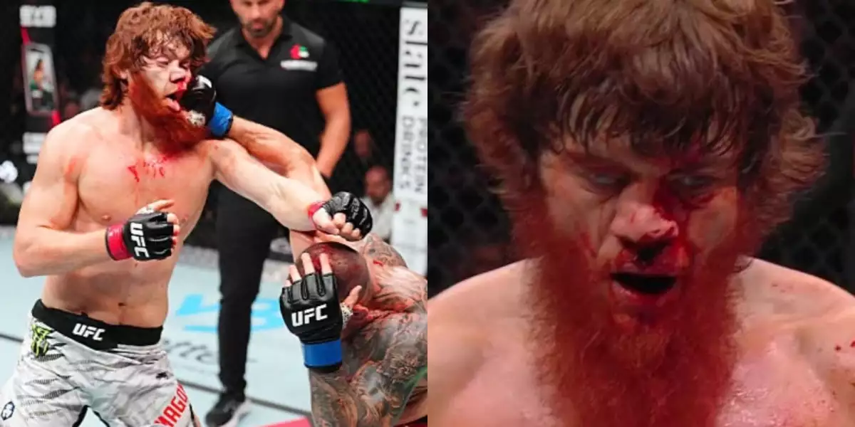 VIDEO: Děsivý Magomedov utrpěl v krvavé bitvě ošklivou zlomeninu nosu