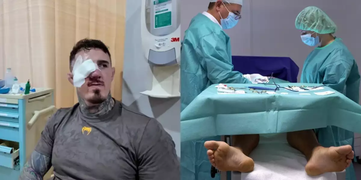 Radši koule než oči? Šampion Aspinall popsal bolestivou operaci