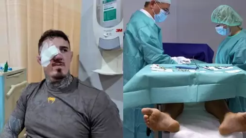 Radši koule než oči? Šampion Aspinall popsal bolestivou operaci