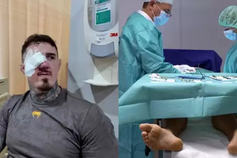 Radši koule než oči? Šampion Aspinall popsal bolestivou operaci