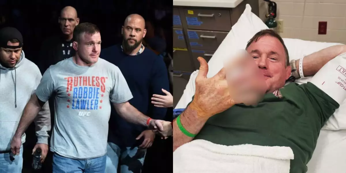 Nejdřív ho srazil vlak, nyní bývalý UFC šampion přišel o kus prstu