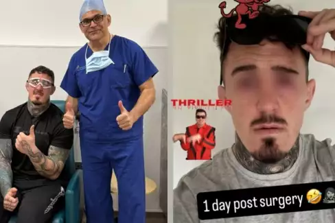 Šampion Aspinall podstoupil další operaci očí! Jak to s ním vypadá?