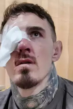 Dělali, co mohli, ale nakonec jsem oslepl! Bývalý šampion varuje Toma Aspinalla