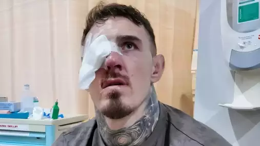 Dělali, co mohli, ale nakonec jsem oslepl! Bývalý šampion varuje Toma Aspinalla