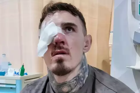 Dělali, co mohli, ale nakonec jsem oslepl! Bývalý šampion varuje Toma Aspinalla