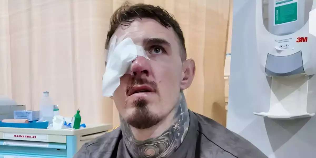 Dělali, co mohli, ale nakonec jsem oslepl! Bývalý šampion varuje Toma Aspinalla