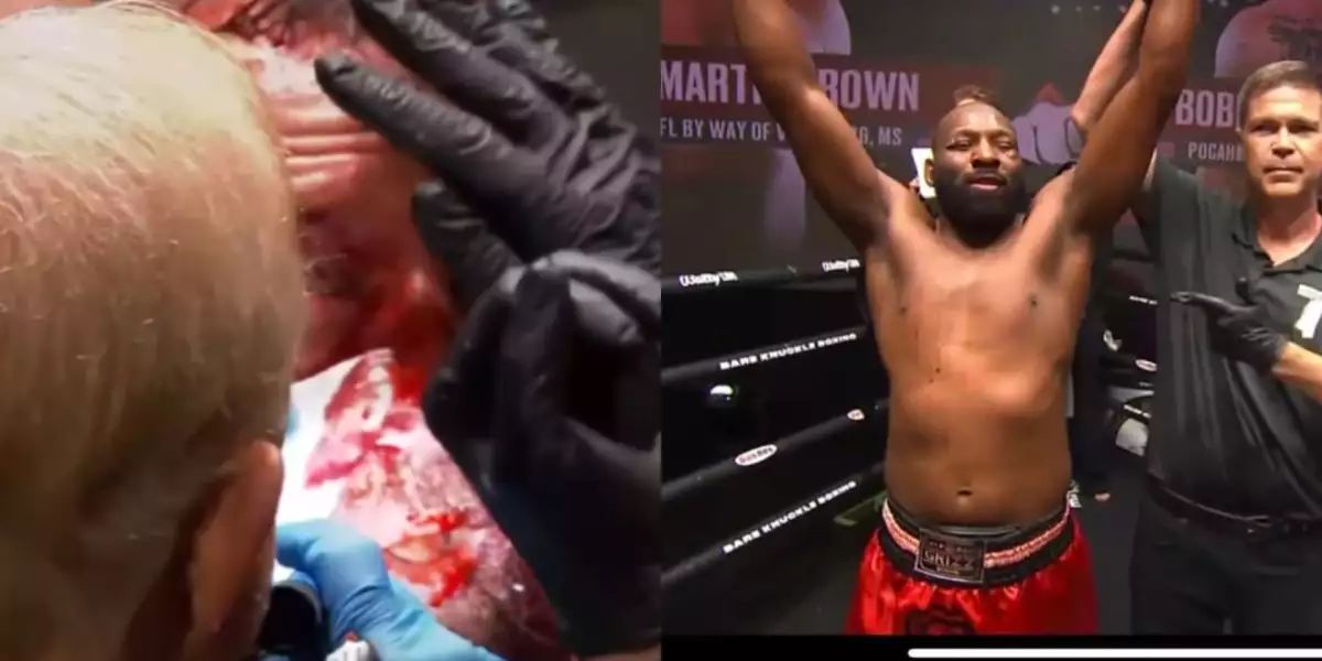 VIDEO: Doktor musel do akce! Borec měl úplně rozsekanou tvář