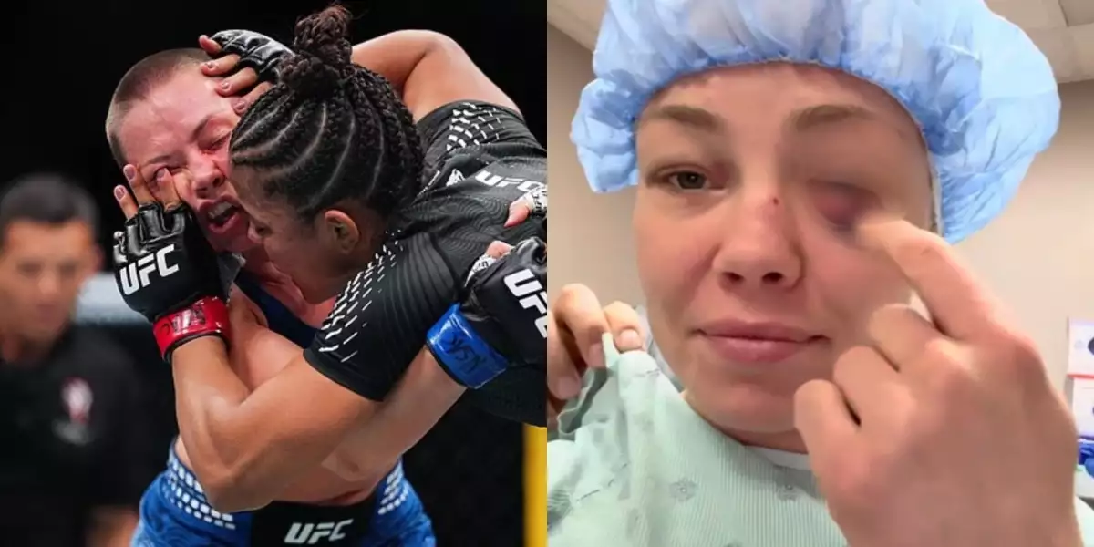 Další problémy s očima v UFC? Bývalá šampionka Namajunas podstoupila operaci!
