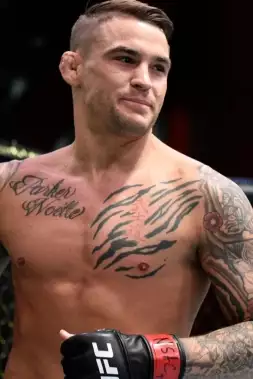 Poirier se stále udržuje v kondici! V tréninku však utrpěl ošklivé zranění