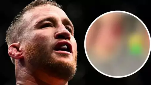 FOTO: Justin Gaethje se po zápase s Fizievem pochlubil ošklivým zraněním