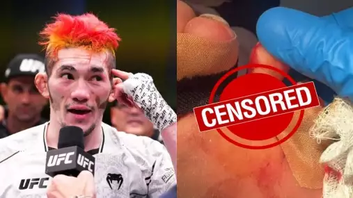 Děsivý obrázek: Šéf UFC Dana White sdílel video nevšedního zranění