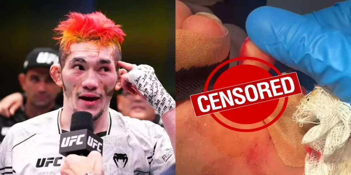 Děsivý obrázek: Šéf UFC Dana White sdílel video nevšedního zranění