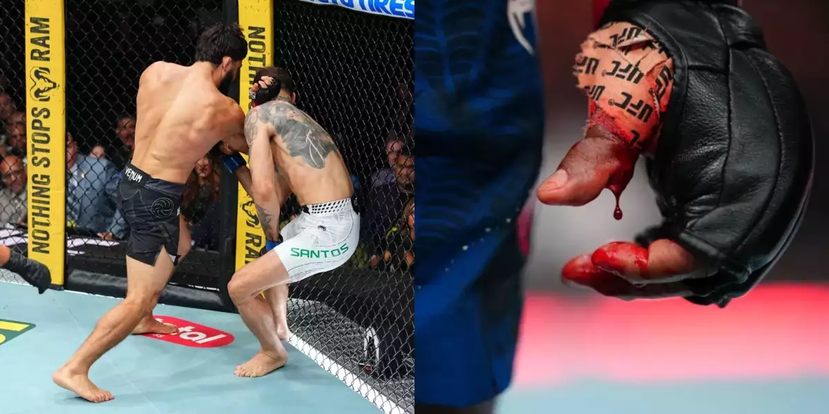 UFC 331 si vybralo krutou daň! Hned několik bojovníků dostalo půlroční stopku