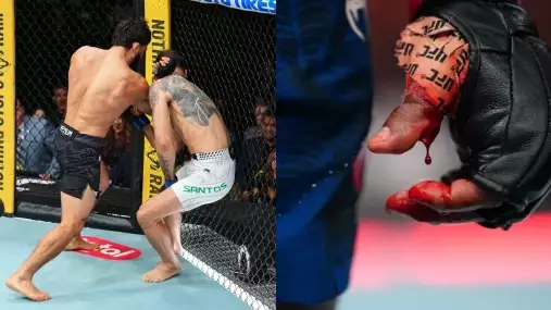 UFC 331 si vybralo krutou daň! Hned několik bojovníků dostalo půlroční stopku