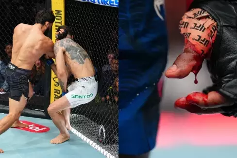 UFC 331 si vybralo krutou daň! Hned několik bojovníků dostalo půlroční stopku