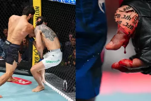 UFC 331 si vybralo krutou daň! Hned několik bojovníků dostalo půlroční stopku