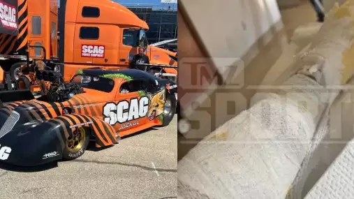 Legendární UFC veterán musel být po nehodě transportován do popáleninového centra