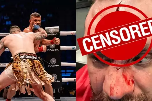 Americký masakr holýma rukama! Zápasník BKFC sdílel děsivé fotky