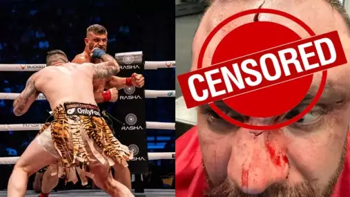 Americký masakr holýma rukama! Zápasník BKFC sdílel děsivé fotky