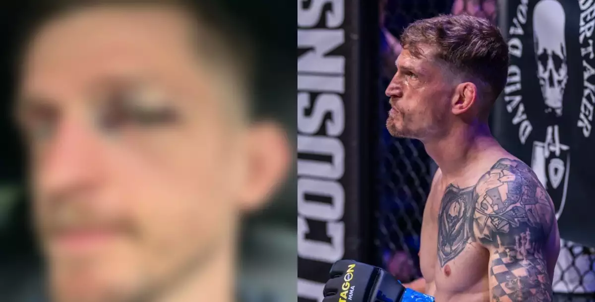 UFC veterán David Dvořák odhalil, jak se vyvíjelo jeho zranění