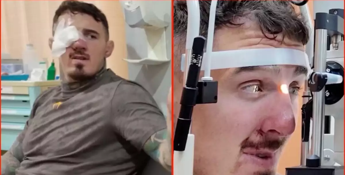 Mohl pokračovat? Tom Aspinall informuje, jak je na tom jeho oko