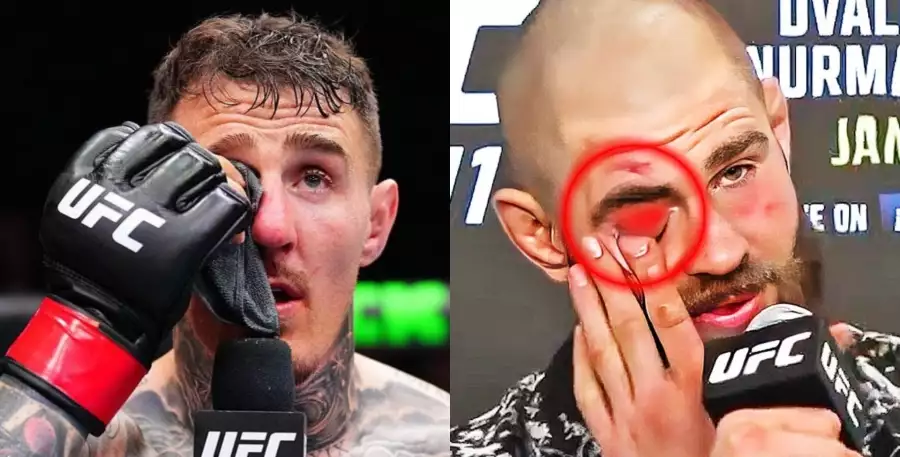 MMA svět vyzdvihuje, jak na dloubanec do oka reagoval Procházka