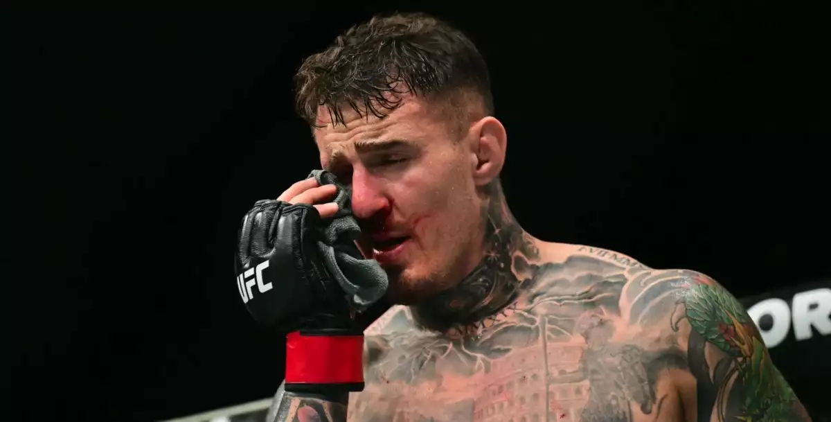 Horší než zničené koleno? Aspinall popisuje ošklivé zranění oka