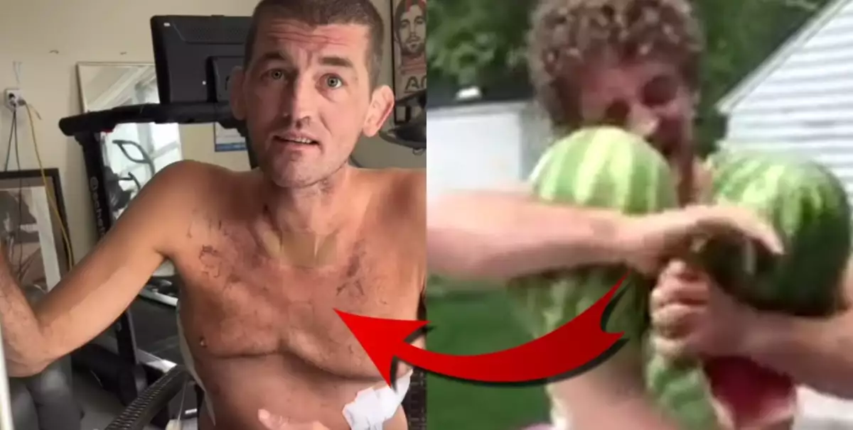 VIDEO: Nedávno drtil melouny! Nyní Askren bojuje s vlastním tělem