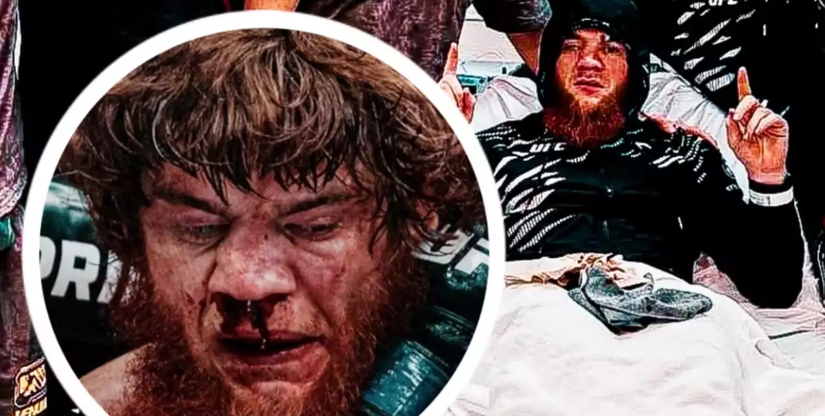 Děsivý Shara Magomedov musel hned po poslední bitvě na operaci